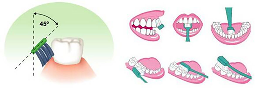 Teeth_4.jpg
