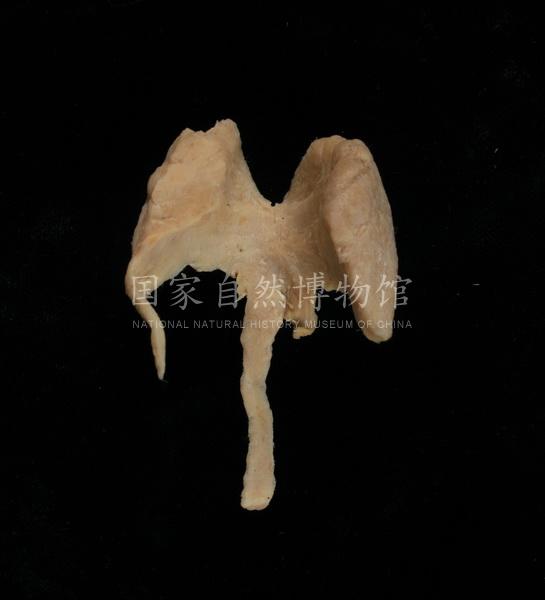 甲状腺_2.jpg